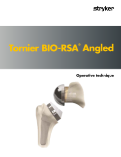 Tornier BIO-RSA | Stryker